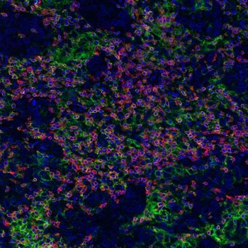 CD3E, CD8 alpha, PD-L1 Antibody