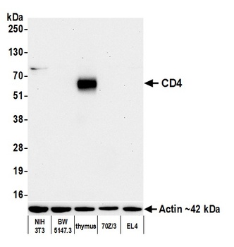 Rabbit anti-CD4 Recombinant Monoclonal Antibody