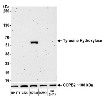 Rabbit anti-Tyrosine Hydroxylase Recombinant Monoclonal Antibody