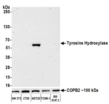 Tyrosine Hydroxylase Antibody
