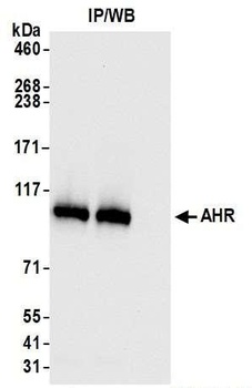 Rabbit anti-AHR Recombinant Monoclonal Antibody