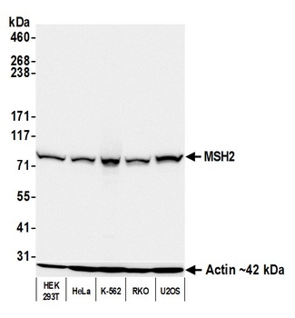 Rabbit anti-MSH2 Recombinant Monoclonal Antibody