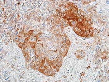 Rabbit anti-ALDH1A1 Recombinant Monoclonal Antibody