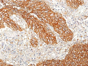 Rabbit anti-E-Cadherin Recombinant Monoclonal Antibody