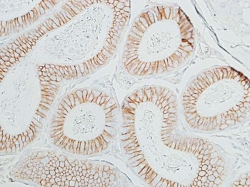 Rabbit anti-beta Catenin Recombinant Monoclonal Antibody