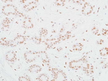Rabbit anti-MED12 Recombinant Monoclonal Antibody