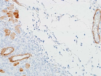 Rabbit anti-alpha Smooth Muscle Actin Recombinant Monoclonal Antibody