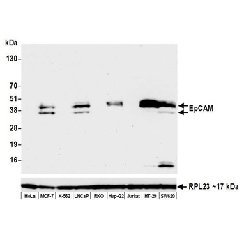 Rabbit anti-EpCAM Recombinant Monoclonal Antibody