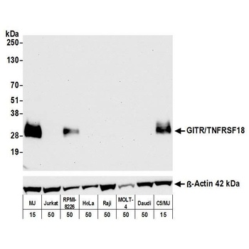 GITR/TNFRSF18 Antibody