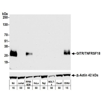 Rabbit anti-GITR/TNFRSF18 Recombinant Monoclonal Antibody