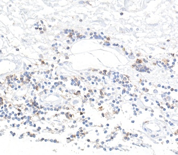 CD96 Antibody