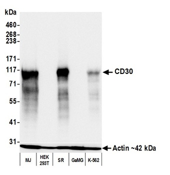 Rabbit anti-CD30 Recombinant Monoclonal Antibody