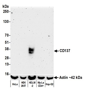 Rabbit anti-CD137 Recombinant Monoclonal Antibody