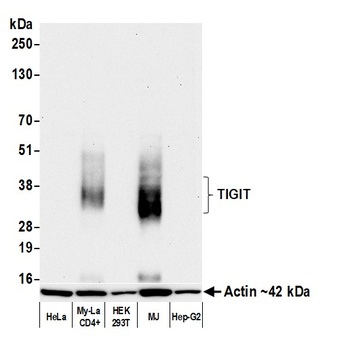 Rabbit anti-TIGIT Recombinant Monoclonal Antibody