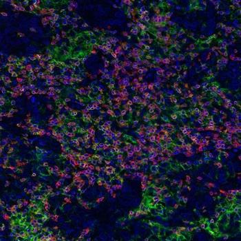 Rabbit anti-CD8 alpha Recombinant Monoclonal Antibody
