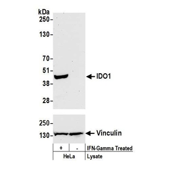 Rabbit anti-IDO1 Recombinant Monoclonal Antibody