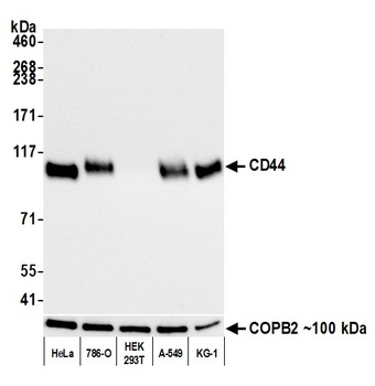 Rabbit anti-CD44 Recombinant Monoclonal Antibody