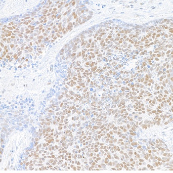Rabbit anti-MED1 Recombinant Monoclonal Antibody