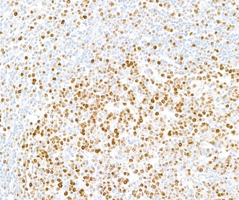 Rabbit anti-Ki-67 Recombinant Monoclonal Antibody