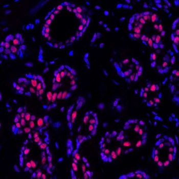 Rabbit anti-PBRM1 Recombinant Monoclonal Antibody