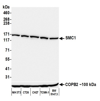 Rabbit anti-SMC1 Recombinant Monoclonal Antibody
