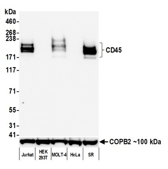 Rabbit anti-CD45 Recombinant Monoclonal Antibody