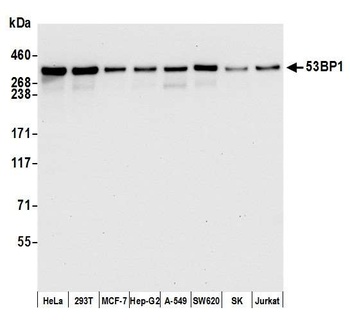 53BP1 Antibody