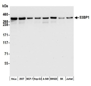 Rabbit anti-53BP1 Recombinant Monoclonal Antibody
