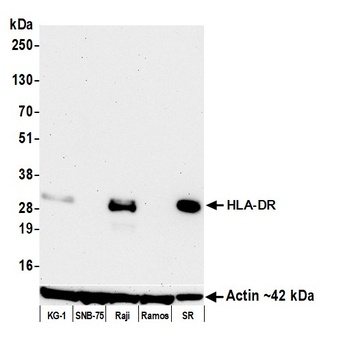 Mouse anti-HLA-DR Monoclonal Antibody