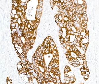 Mouse anti-Cytokeratin Monoclonal Antibody