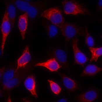 Cytokeratin Mouse Monoclonal Antibody