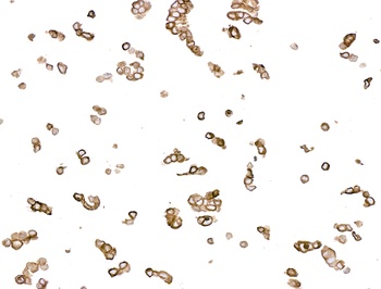 Cytokeratin Mouse Monoclonal Antibody