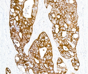 Cytokeratin Antibody