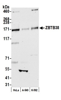 ZBTB38 Antibody