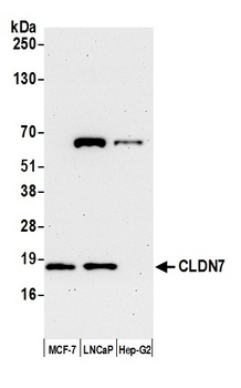 CLDN7 Antibody