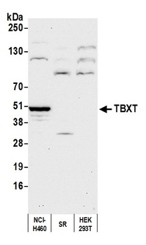 TBXT Antibody