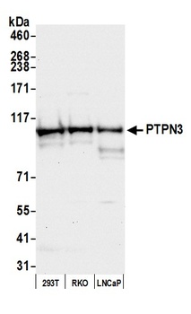 PTPN3 Antibody