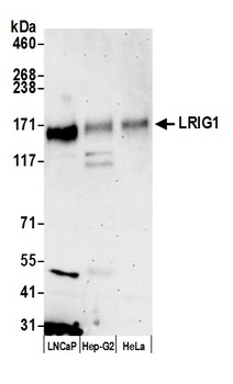 Rabbit anti-LRIG1 Antibody