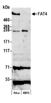 Rabbit anti-FAT4 Antibody