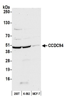 Rabbit anti-CCDC94 Antibody