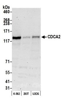 CDCA2 Antibody