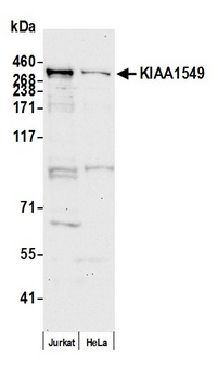 KIAA1549 Antibody