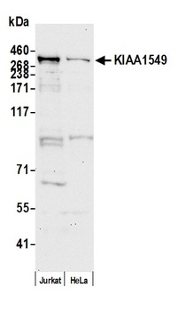 Rabbit anti-KIAA1549 Antibody