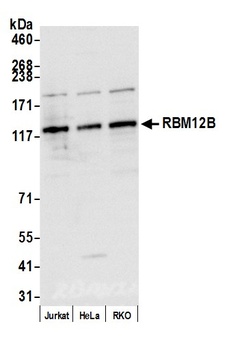 RBM12B Antibody