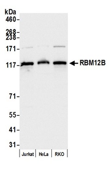 RBM12B Antibody