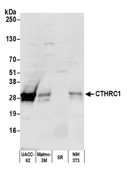 Rabbit anti-CTHRC1 Antibody