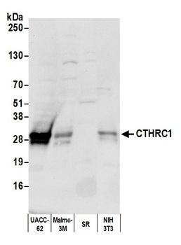 CTHRC1 Antibody