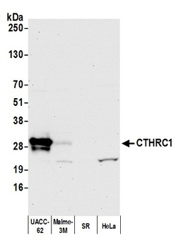 Rabbit anti-CTHRC1 Antibody