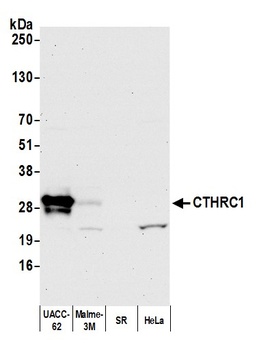 CTHRC1 Antibody