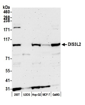 Rabbit anti-DIS3L2 Antibody